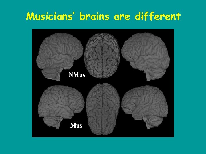 Musicians’ brains are different 