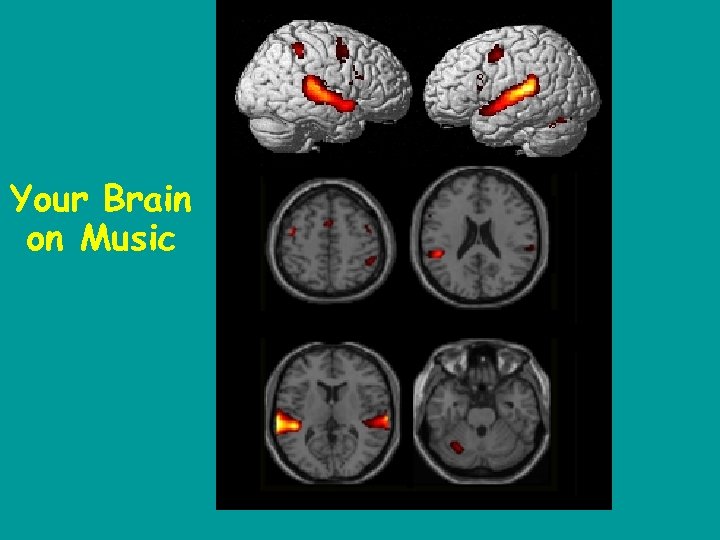 Your Brain on Music 