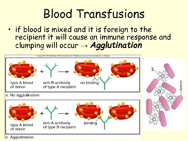 Blood Transfusions • if blood is mixed and it is foreign to the recipient