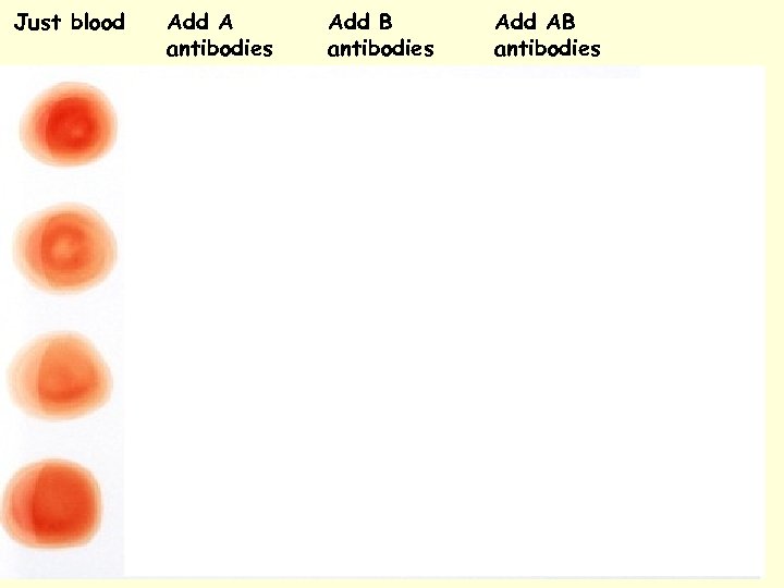 Just blood Add A antibodies Add B antibodies Add AB antibodies 