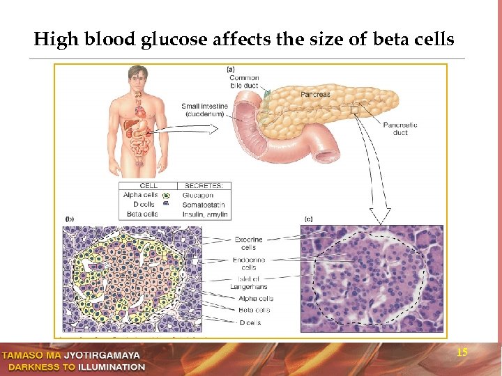 High blood glucose affects the size of beta cells 15 