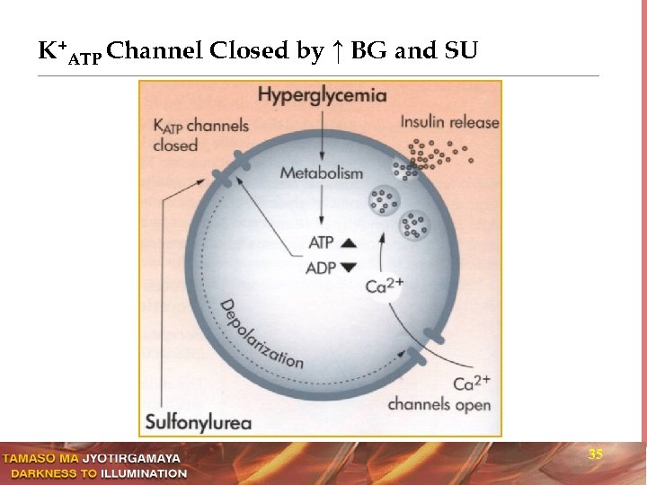 K+ATP Channel Closed by ↑ BG and SU 35 
