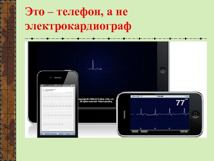 Это – телефон, а не электрокардиограф 