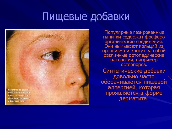 Пищевые добавки Популярные газированные напитки содержат фосфоро органические соединения. Они вымывают кальций из организма