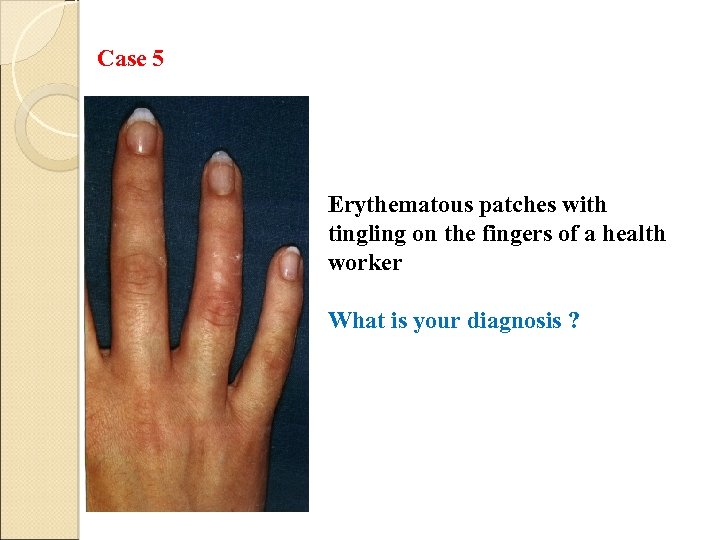 Case 5 Erythematous patches with tingling on the fingers of a health worker What