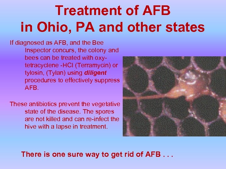 Treatment of AFB in Ohio, PA and other states If diagnosed as AFB, and