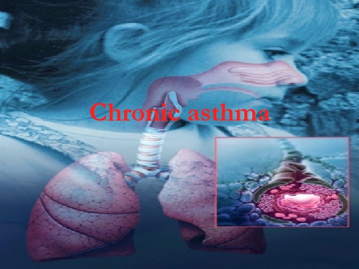 Chronic asthma 