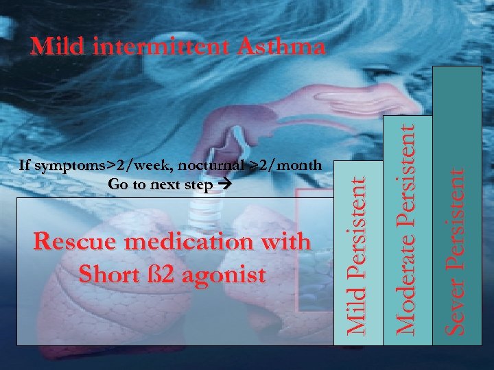 Sever Persistent Rescue medication with Short ß 2 agonist Moderate Persistent If symptoms>2/week, nocturnal