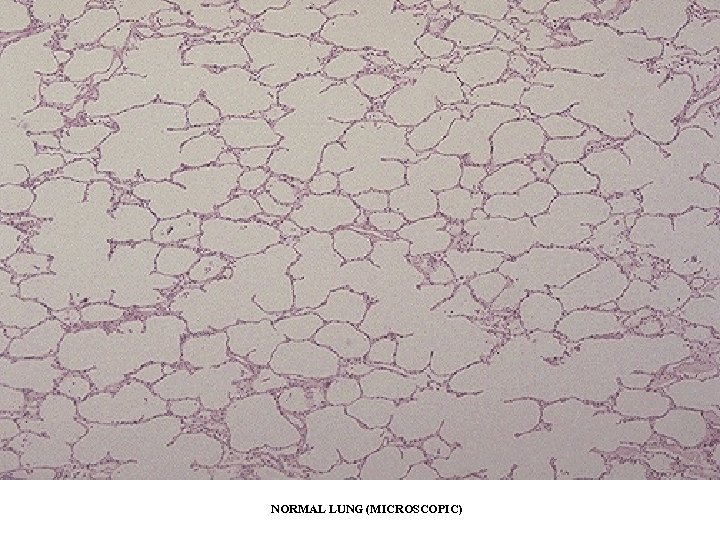 NORMAL LUNG (MICROSCOPIC) 