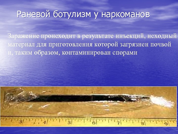 Раневой ботулизм у наркоманов Заражение происходит в результате инъекций, исходный материал для приготовления которой