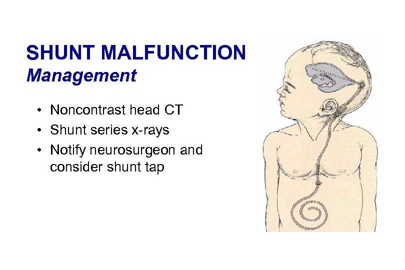 SHUNT MALFUNCTION Management • Noncontrast head CT • Shunt series x-rays • Notify neurosurgeon