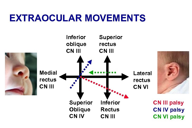 EXTRAOCULAR MOVEMENTS Inferior oblique CN III Superior rectus CN III Medial rectus CN III