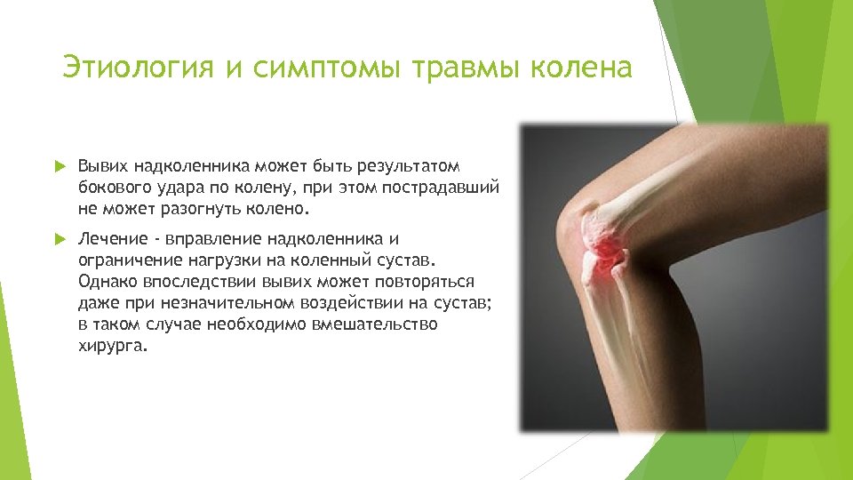 Этиология и симптомы травмы колена Вывих надколенника может быть результатом бокового удара по колену,
