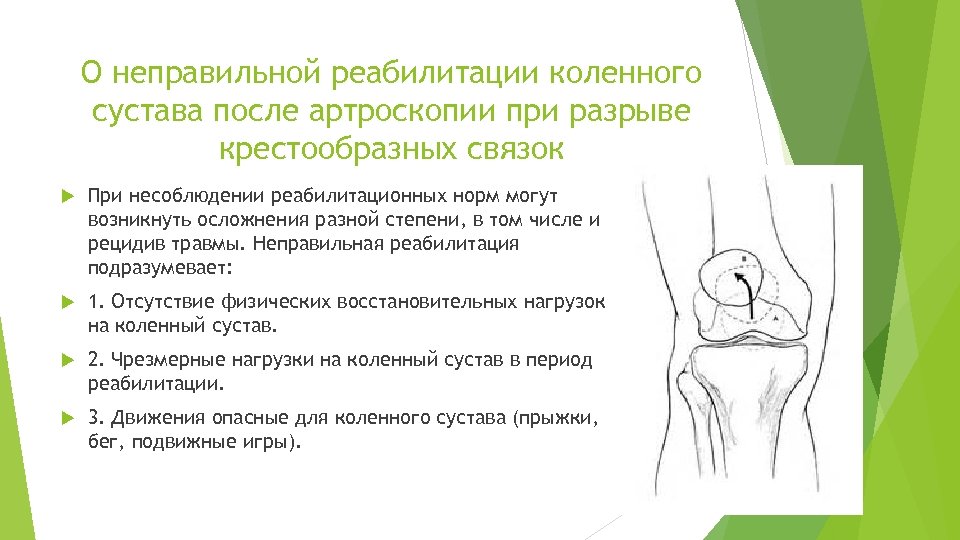 О неправильной реабилитации коленного сустава после артроскопии при разрыве крестообразных связок При несоблюдении реабилитационных