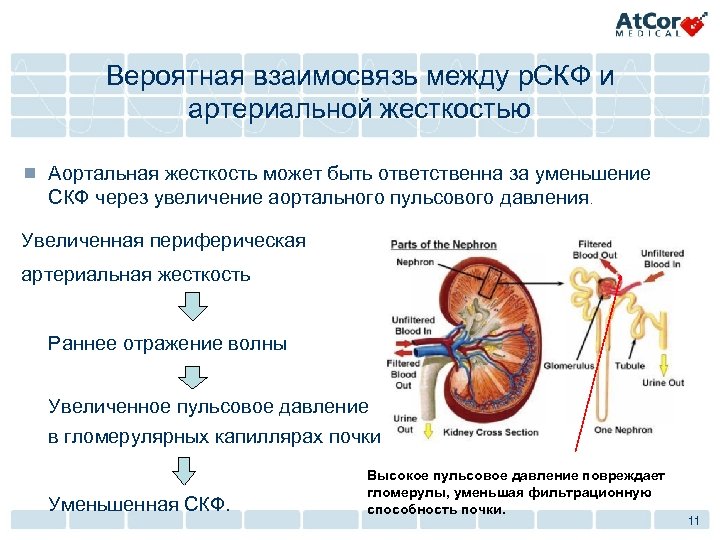 Вероятная взаимосвязь между р. СКФ и артериальной жесткостью ¾ Аортальная жесткость может быть ответственна