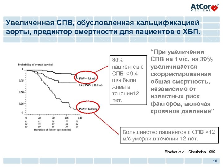 Увеличенная СПВ, обусловленная кальцификацией аорты, предиктор смертности для пациентов с ХБП. 80% пациентов с