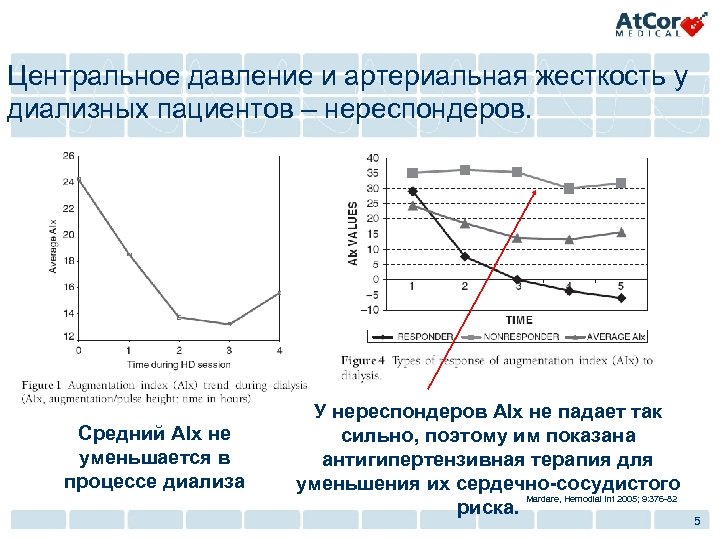 Центральное давление и артериальная жесткость у диализных пациентов – нереспондеров. Средний AIx не уменьшается