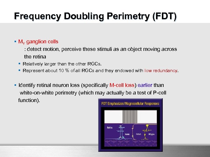 FDT Frequency Doubling Perimetry (FDT) § MY ganglion cells : detect motion, perceive these