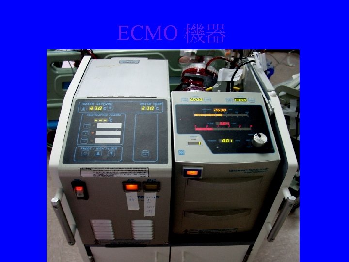 ECMO 機器 