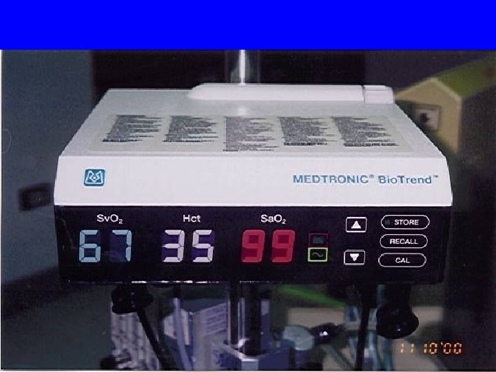 MX-2 monitor 