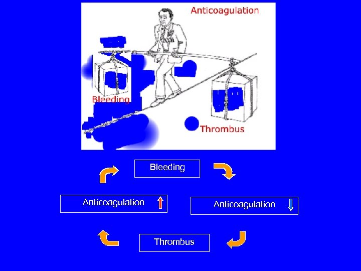 Bleeding Anticoagulation Thrombus 