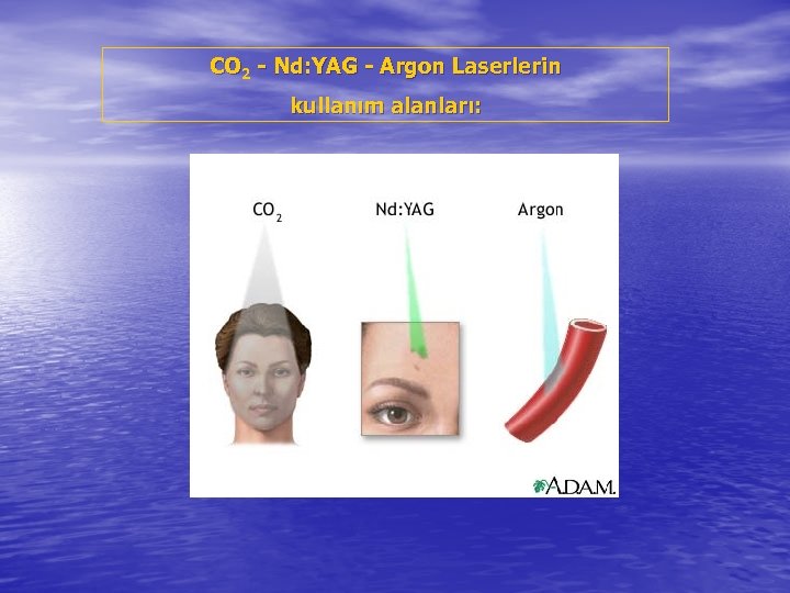 CO 2 - Nd: YAG - Argon Laserlerin kullanım alanları: 