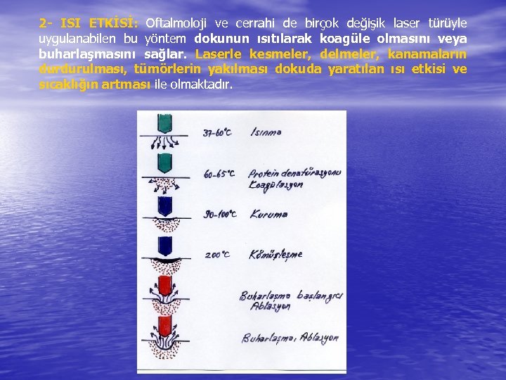 2 - ISI ETKİSİ: Oftalmoloji ve cerrahi de birçok değişik laser türüyle uygulanabilen bu