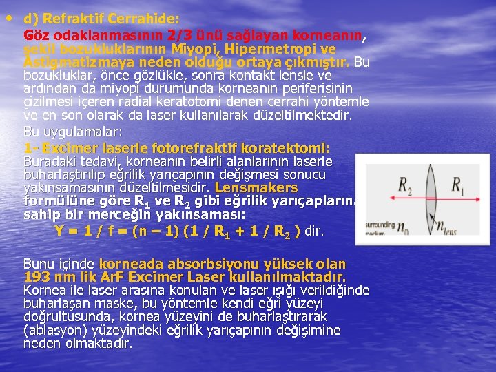  • d) Refraktif Cerrahide: Göz odaklanmasının 2/3 ünü sağlayan korneanın, şekil bozukluklarının Miyopi,