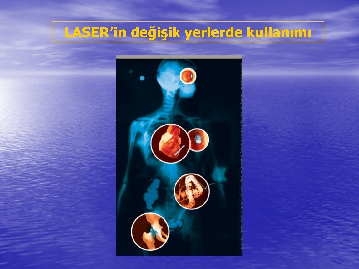 LASER’in değişik yerlerde kullanımı 