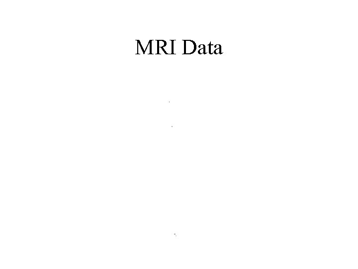 MRI Data 