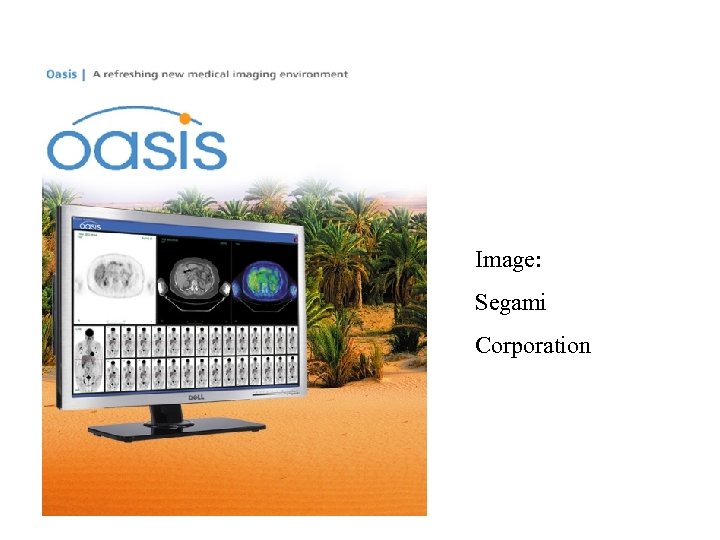 Image: Segami Corporation 