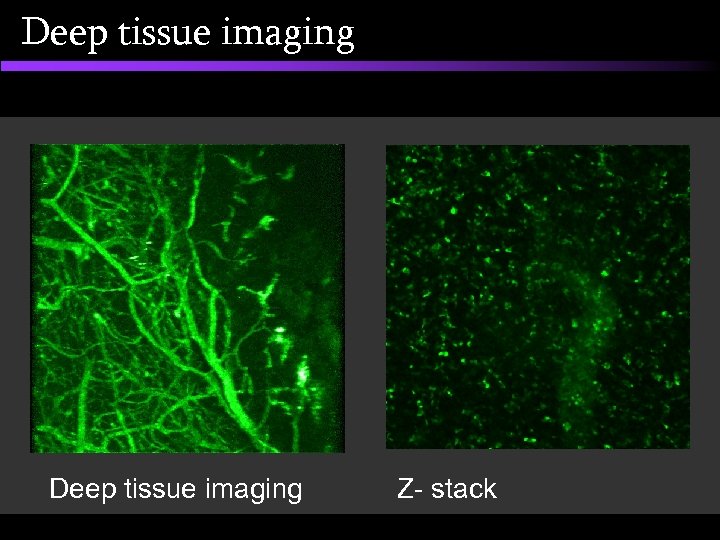 Deep tissue imaging Z- stack 