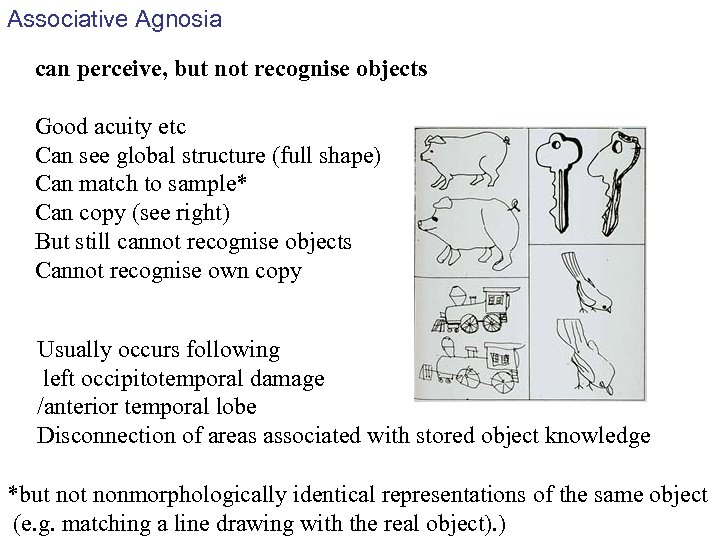 Associative Agnosia can perceive, but not recognise objects Good acuity etc Can see global