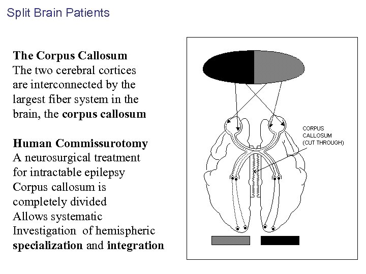 Split Brain Patients The Corpus Callosum The two cerebral cortices are interconnected by the