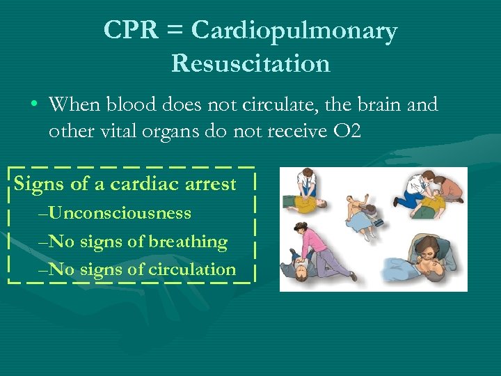 CPR = Cardiopulmonary Resuscitation • When blood does not circulate, the brain and other