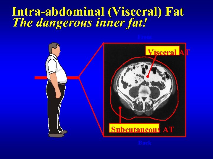 Intra-abdominal (Visceral) Fat The dangerous inner fat! Front Visceral AT Subcutaneous AT Back 