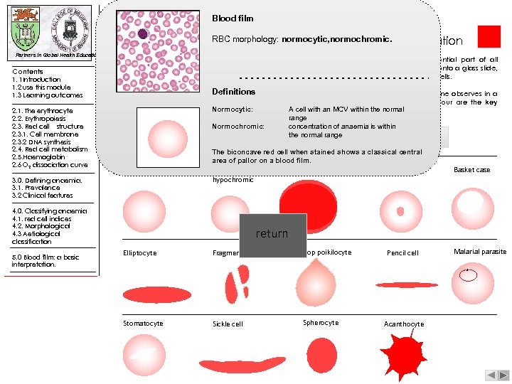 Blood film RBC morphology: normocytic, normochromic. |blood film: a basic interpretation Partners in Global