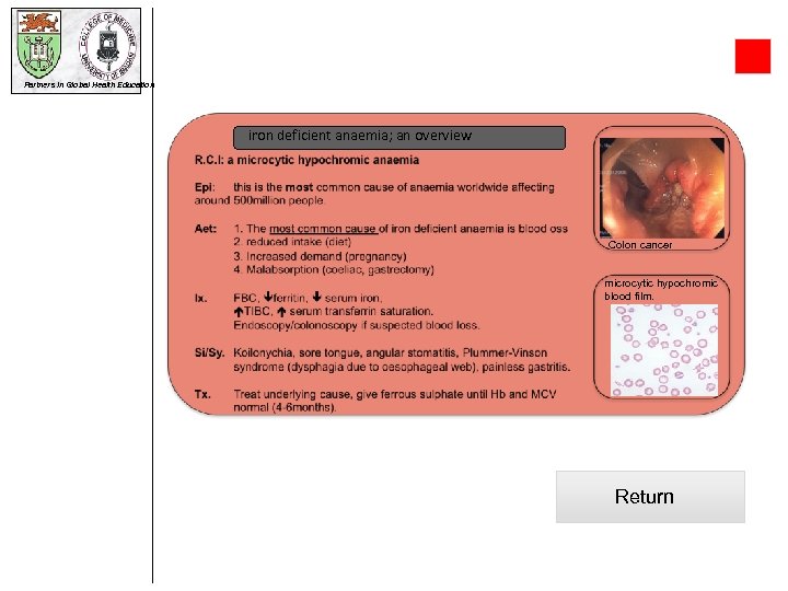 Partners in Global Health Education iron deficient anaemia; an overview Colon cancer microcytic hypochromic