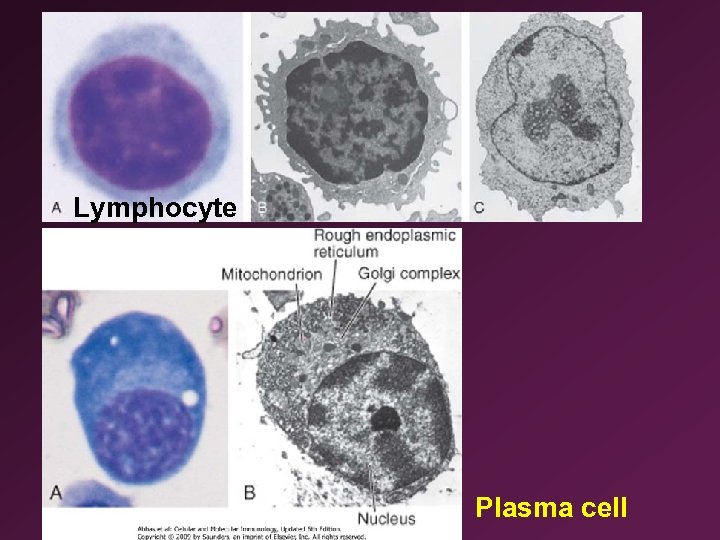 Lymphocyte Plasma cell 