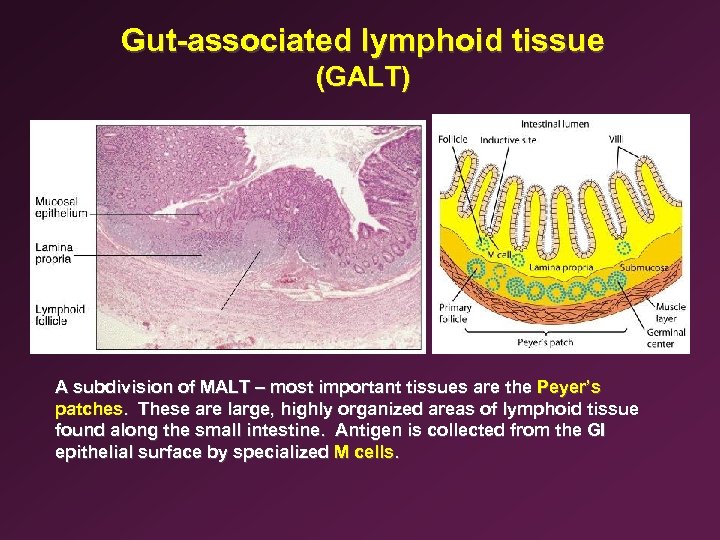 Gut-associated lymphoid tissue (GALT) A subdivision of MALT – most important tissues are the