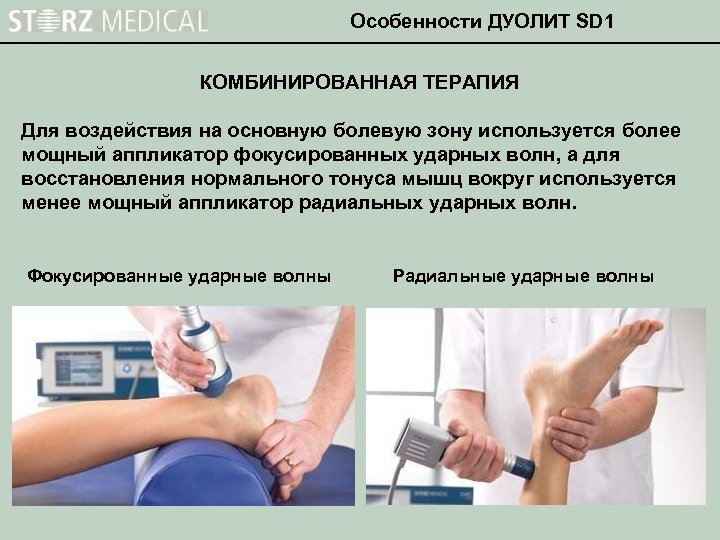 Особенности ДУОЛИТ SD 1 КОМБИНИРОВАННАЯ ТЕРАПИЯ Для воздействия на основную болевую зону используется более