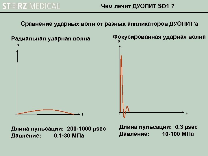 Чем лечит ДУОЛИТ SD 1 ? Сравнение ударных волн от разных аппликаторов ДУОЛИТ’а Радиальная
