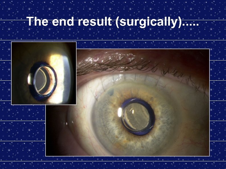 The end result (surgically). . . 