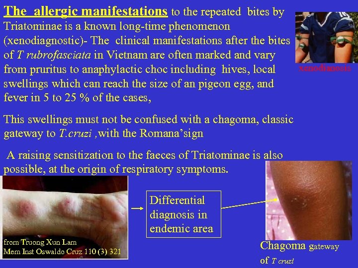 The allergic manifestations to the repeated bites by Triatominae is a known long-time phenomenon