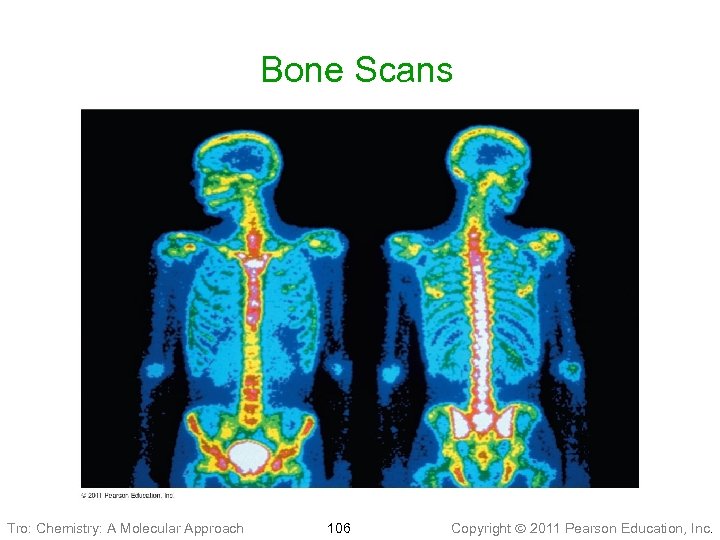 Bone Scans Tro: Chemistry: A Molecular Approach 106 Copyright 2011 Pearson Education, Inc. 