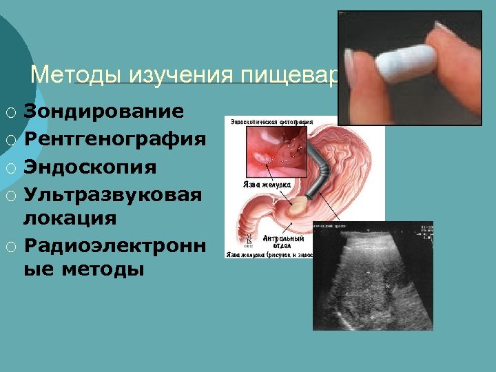 Методы изучения пищеварения: ¡ ¡ ¡ Зондирование Рентгенография Эндоскопия Ультразвуковая локация Радиоэлектронн ые методы