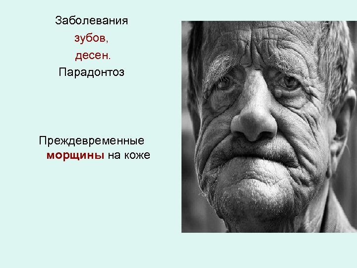 Заболевания зубов, десен. Парадонтоз Преждевременные морщины на коже 