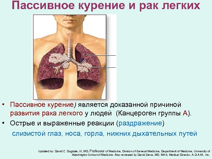 Пассивное курение и рак легких • Пассивное курение) является доказанной причиной развития рака легкого
