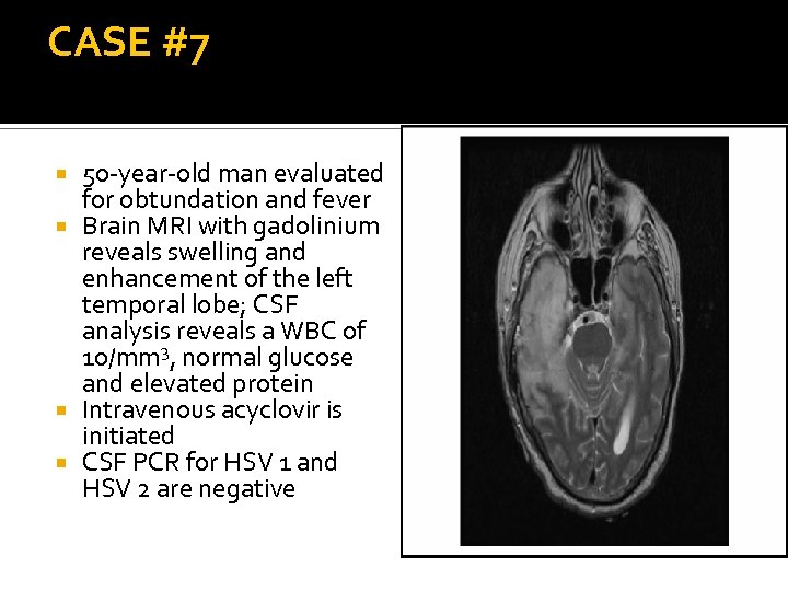 CASE #7 50 -year-old man evaluated for obtundation and fever Brain MRI with gadolinium