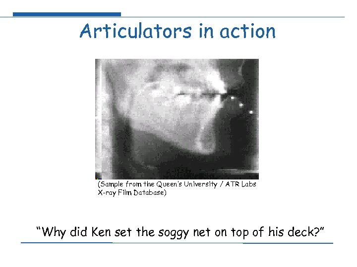 Articulators in action (Sample from the Queen’s University / ATR Labs X-ray Film Database)